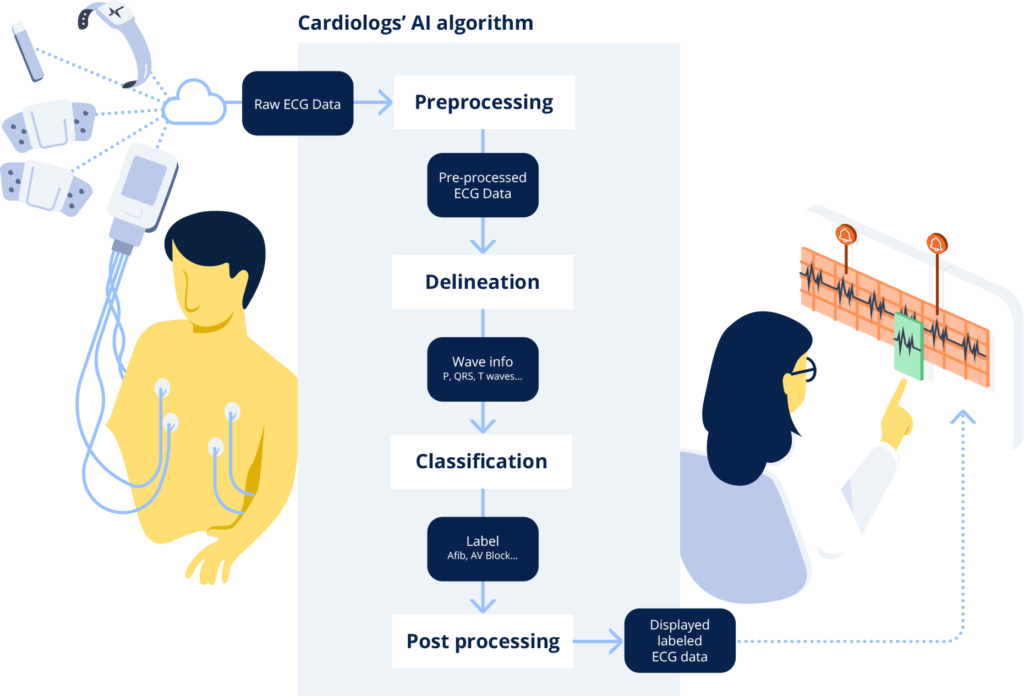 AI-Enhanced Heart Failure Screening Demonstrates Cost-Effectiveness