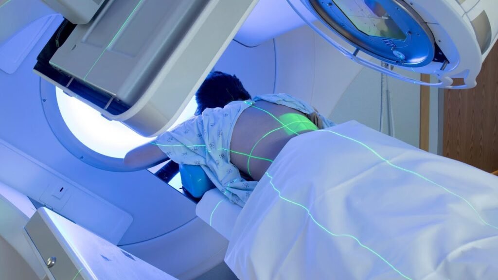 AI Enhancements in Radiotherapy for Prostate Cancer
