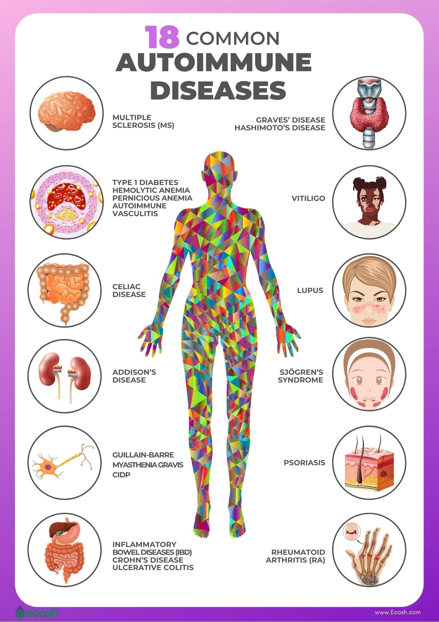 AI Method Enhances Prediction of Autoimmune Disease Progression