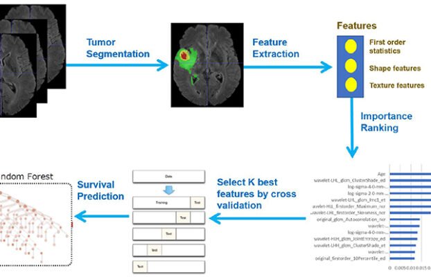 AIModelOffersNonInvasiveDetectionofBrainCancerSpread Yesil Science AI Model Offers Non Invasive Detection of Brain Cancer Spread