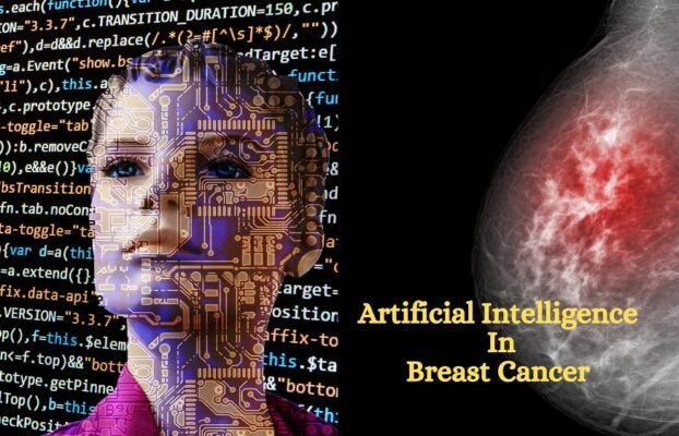 New AI Trial for Early Detection of Breast Cancer