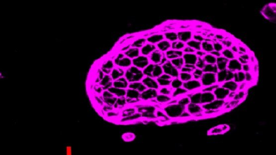 Brain Imaging Insights for Anxiety Care App Effectiveness