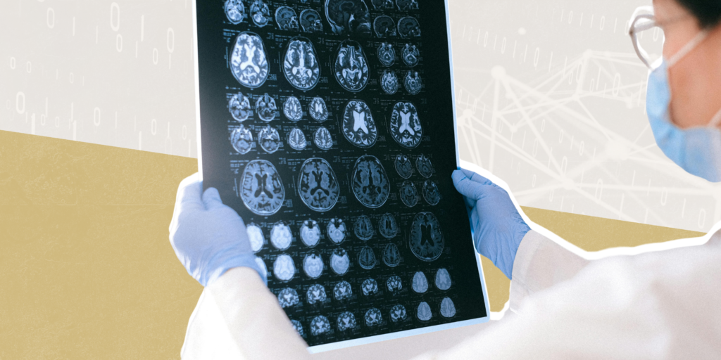 Open-Source AI Tools Enhance Medical Scan Reporting for Doctors