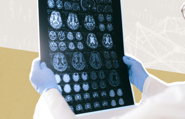 Open Source AI Tools Enhance Medical Scan Reporting for Doctors