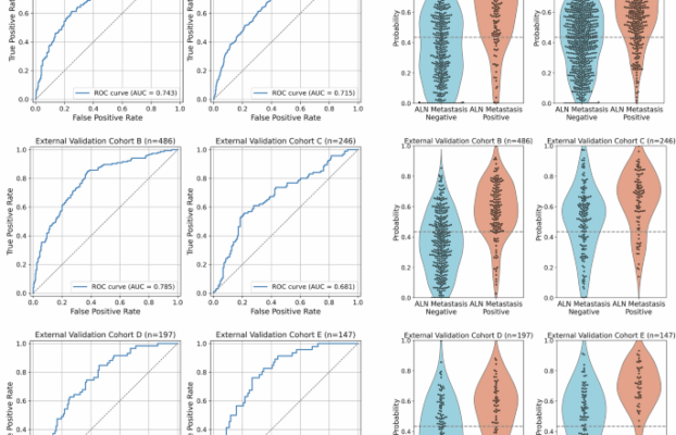 AI Model Suggests 40% of Breast Cancer Patients May Skip Axillary Surgery