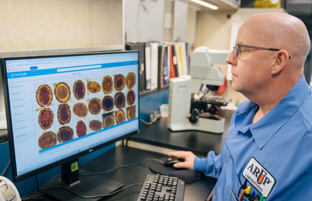 AI Outperforms Humans in Identifying Intestinal Parasites in Stool Samples