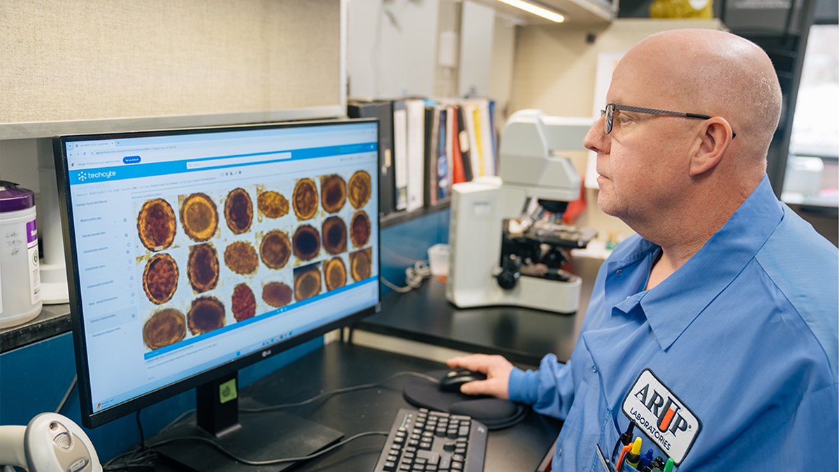 AI Outperforms Humans in Identifying Intestinal Parasites in Stool Samples