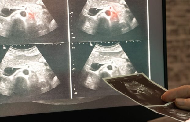 NewAIToolEnhancesMedicalImagingEfficiencyby90 Yesil Science New AI Tool Enhances Medical Imaging Efficiency by 90