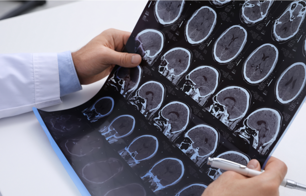 Impact of AI Integration on Medical Liability Perception