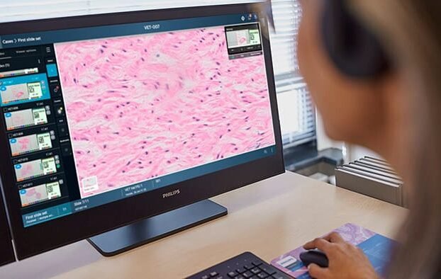 Philips Enhances Digital Pathology with Cloud Enabled IntelliSite Solution