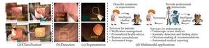 EnhancingMultimodalIntelligenceinColonoscopy Yesil Science Enhancing Multimodal Intelligence in Colonoscopy