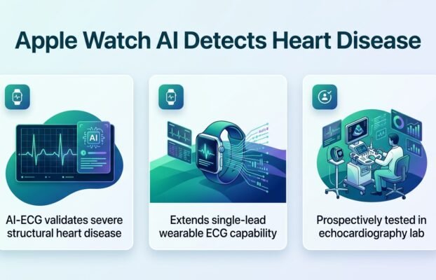 Apple Watch AI detects severe structural heart disease